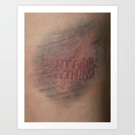264x264 Bruise Art Prints - Bruise Drawing