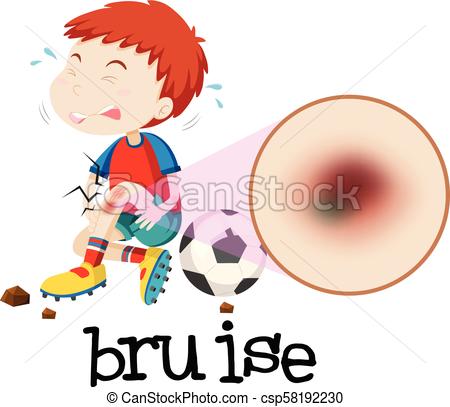 450x407 A Young Boy Habing Bruise Illustration - Bruise Drawing