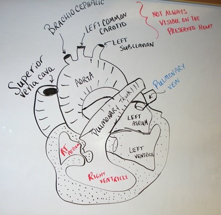 446x434 Unit Cardiovascular System - Cardiovascular System Drawing