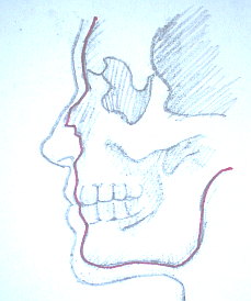 229x274 how to draw a nose - Cartilage Drawing