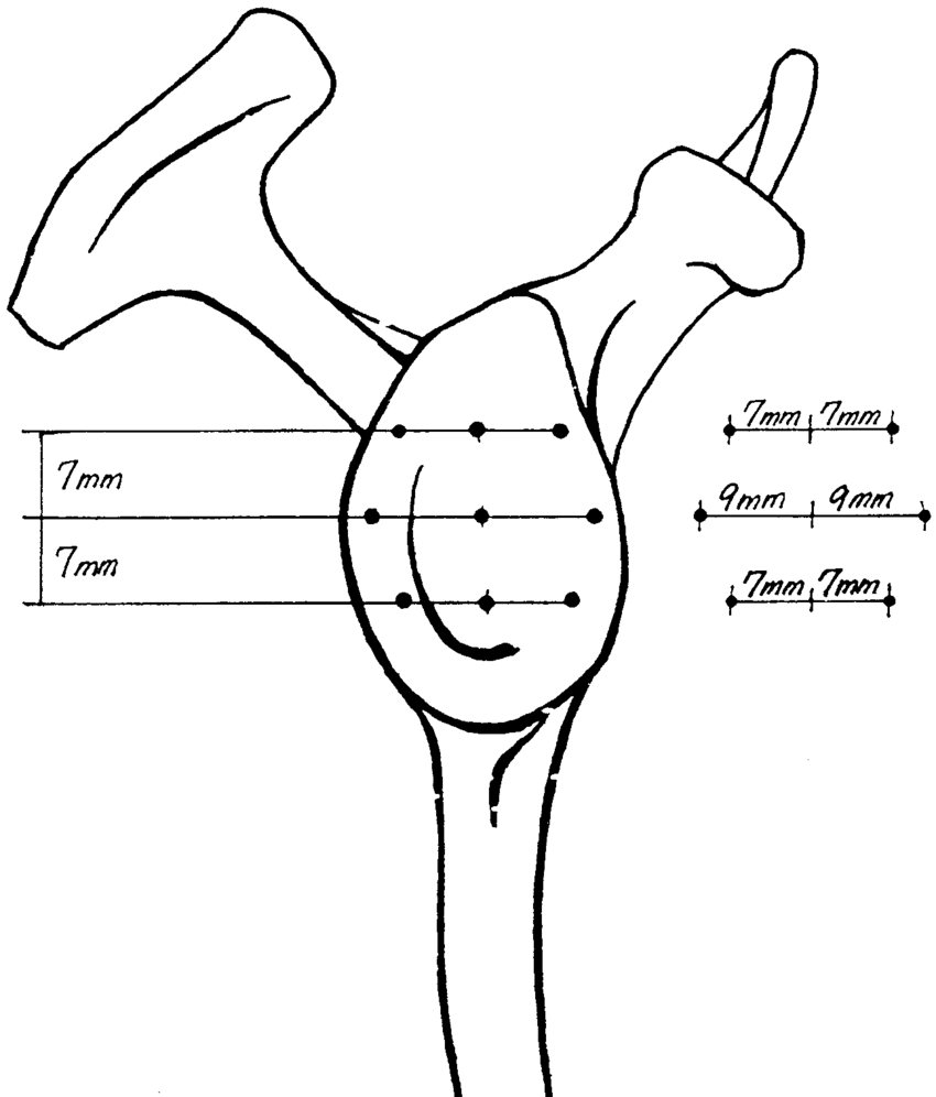 850x996 schematic drawing of the locations of measurement of cartilage - Cartilage Drawing