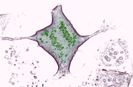 443x289 Cell Division Analysis Looking Inside Life - Cell Division Drawing