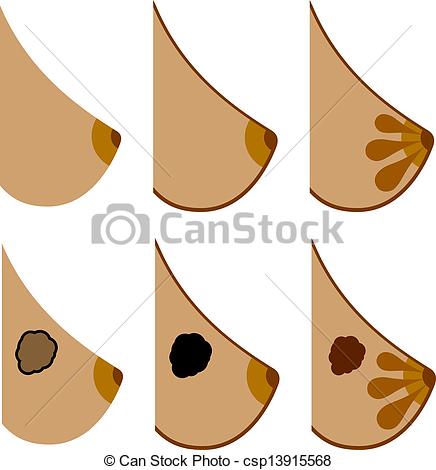 436x470 collection of free drawing turkeys chicken breast download on ui ex - Chicken Breast Drawing