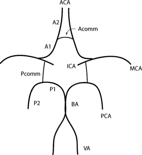 289x314 migraine and circle of willis anomalies - Circle Of Willis Drawing