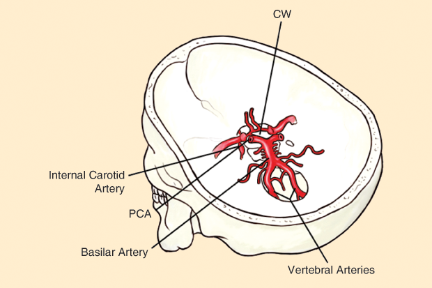 620x413 the brain willis circle and ring electric power systems - Circle Of Willis Drawing