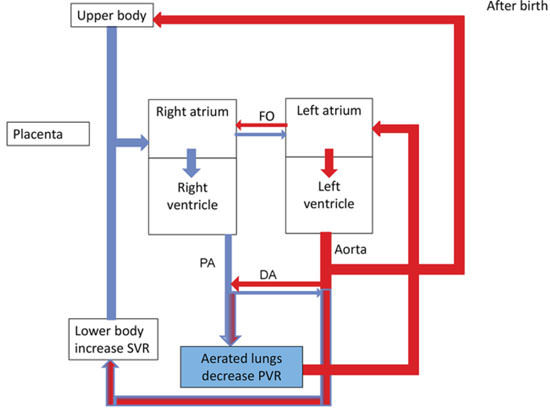 550x408 schematic drawing of the neonatal circulation just after birth - Circulation Drawing