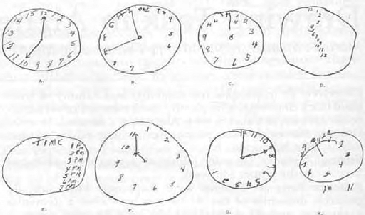 710x418 examples of clock drawing test performance identify cognitive - Clock Drawing