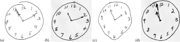 604x144 Clock Drawing Performance In Cognitively Normal Elderly - Clock Drawing Images