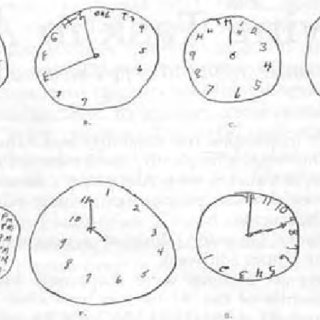 320x320 Examples Of Clock Drawing Test Performance Identify Cognitive - Clock Drawing Images