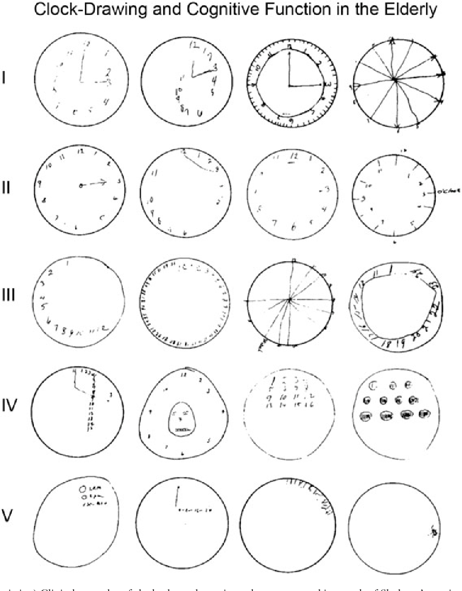 948x1212 Figure From The Test Of Time A History Of Clock Drawing - Clock Drawing Images