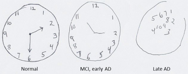 630x249 Clock Drawing And Trump's Cognitive Test - Clock Drawing Images