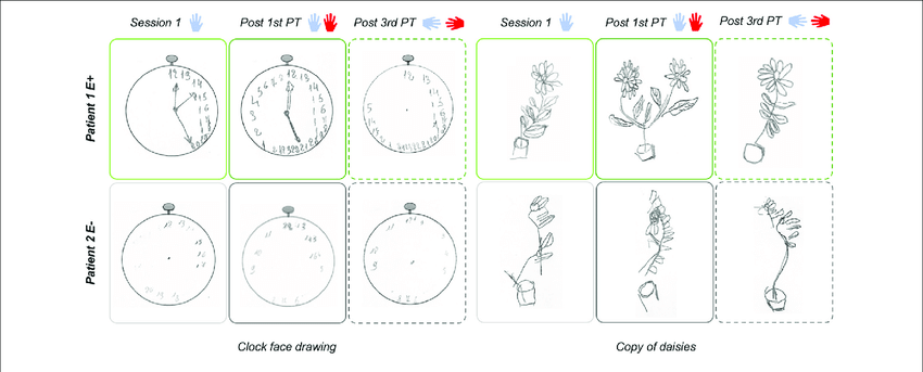 850x343 clock face drawing task and copy of daisies results - Clock Face Drawing