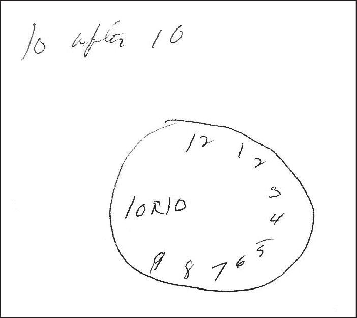 702x625 a patient whose mmse score was was asked to draw a clock face - Clock Face Drawing