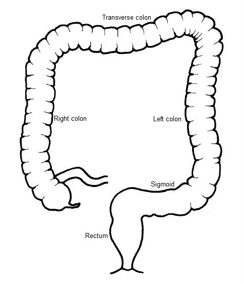 484x560 hirschsprung's disease children's hospital pittsburgh - Colon Drawing
