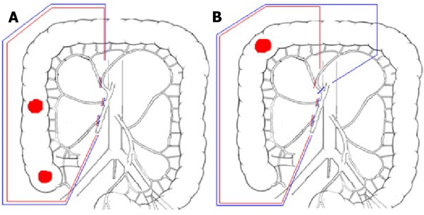 850x432 schematic drawing illustrating the difference between extent - Colon Drawing