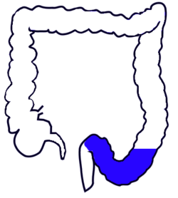 250x278 sigmoid colon - Colon Drawing