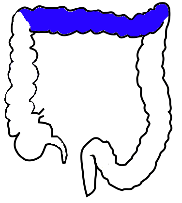 376x418 transverse colon - Colon Drawing