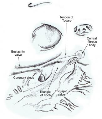 326x380 conduction system of the heart overview, gross anatomy, natural - Conduction Drawing