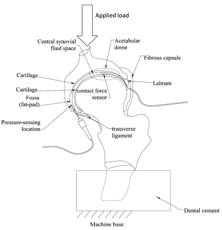 769x798 schematic drawing of the cross section of hip joint showing - Contact Drawing