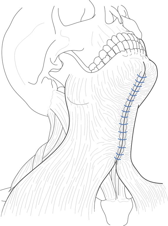 571x768 Medical Drawings Nbg Drafting And Design - Copyright Drawings