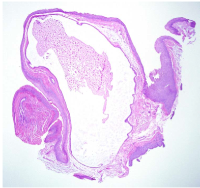 393x370 double feature a puppy trapped in a cyst and a tumor that looks - Cyst Drawing