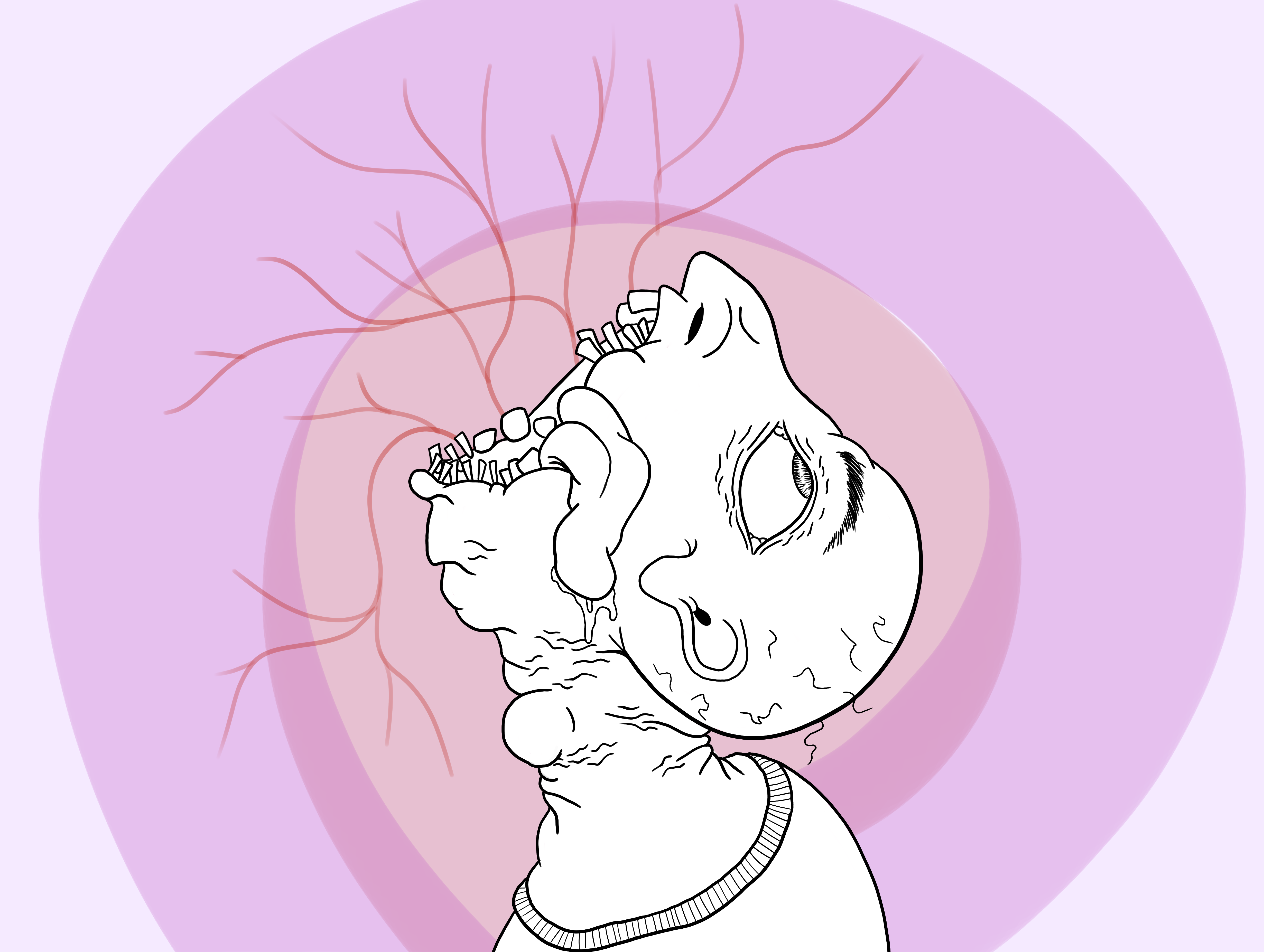 4920x3707 cyst - Cyst Drawing