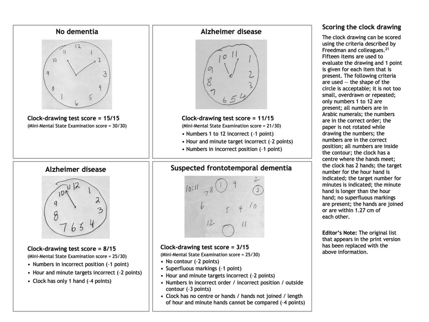 Dementia Clock Drawing at Explore collection of