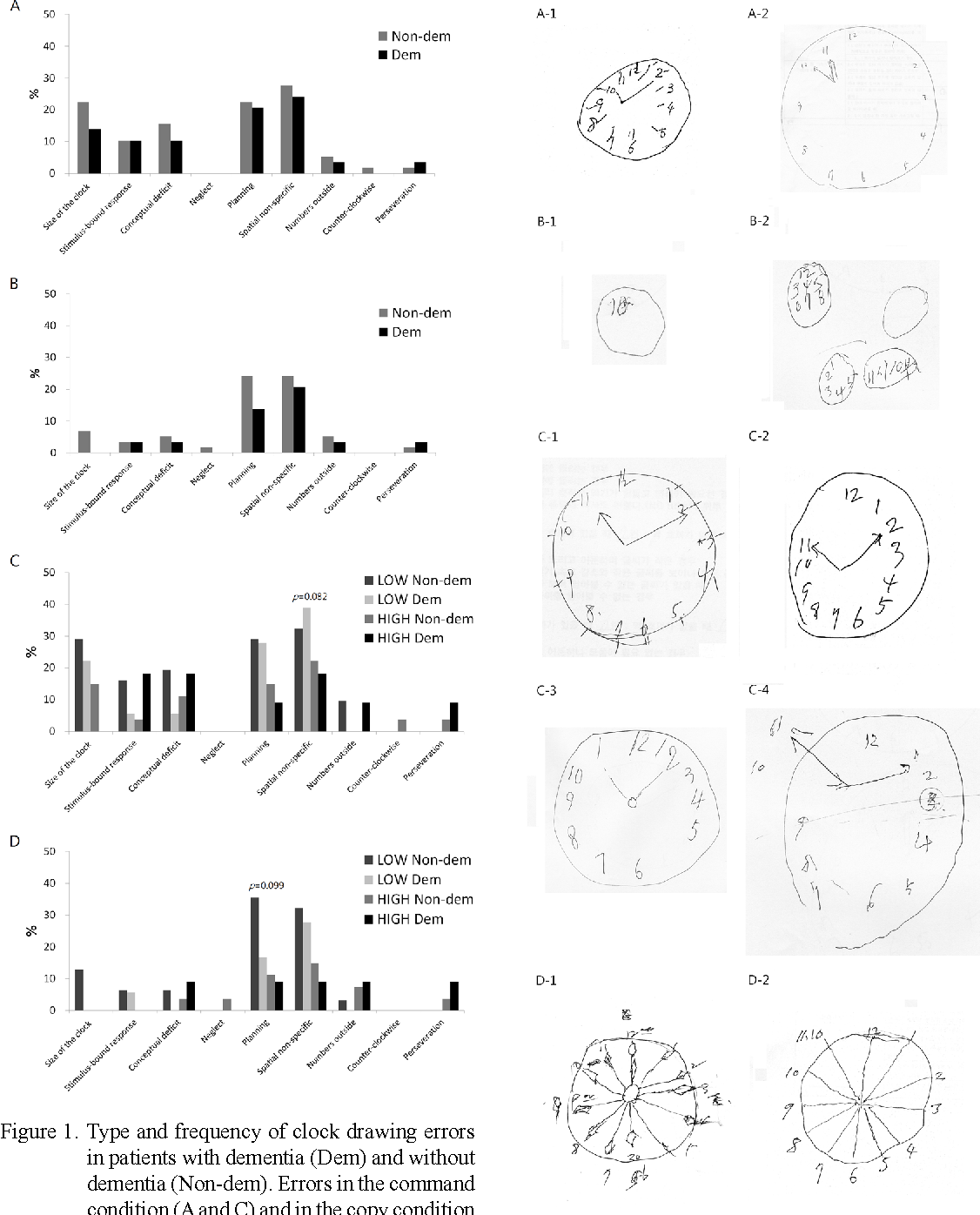 Dementia Clock Drawing at Explore collection of