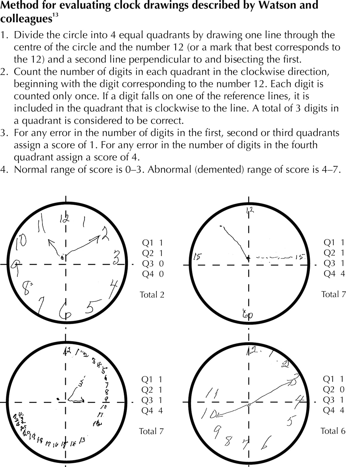 1160x1566 the value of clock drawing in identifying executive cognitive - Dementia Clock Drawing