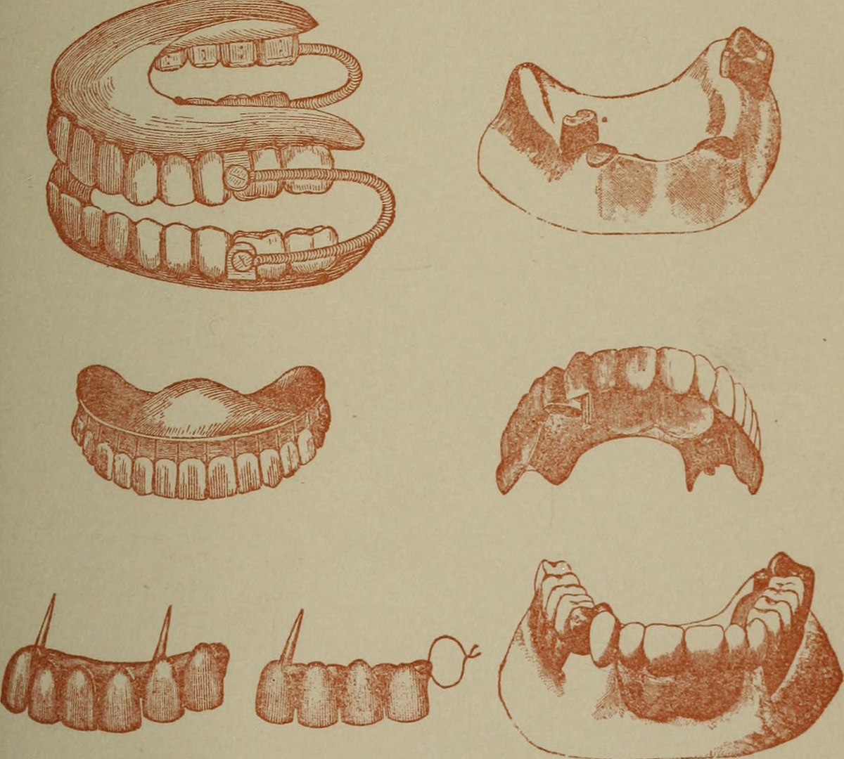Dentures Drawing at Explore collection of Dentures