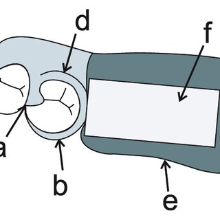 320x320 schematic drawing of removable partial dentures used in the study - Dentures Drawing