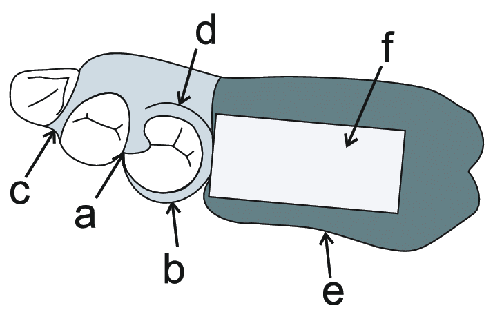 714x462 schematic drawing of removable partial dentures used in the study - Dentures Drawing