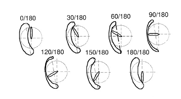 722x396 schematic drawing of relationship between the cam and pump - Diaphragm Drawing