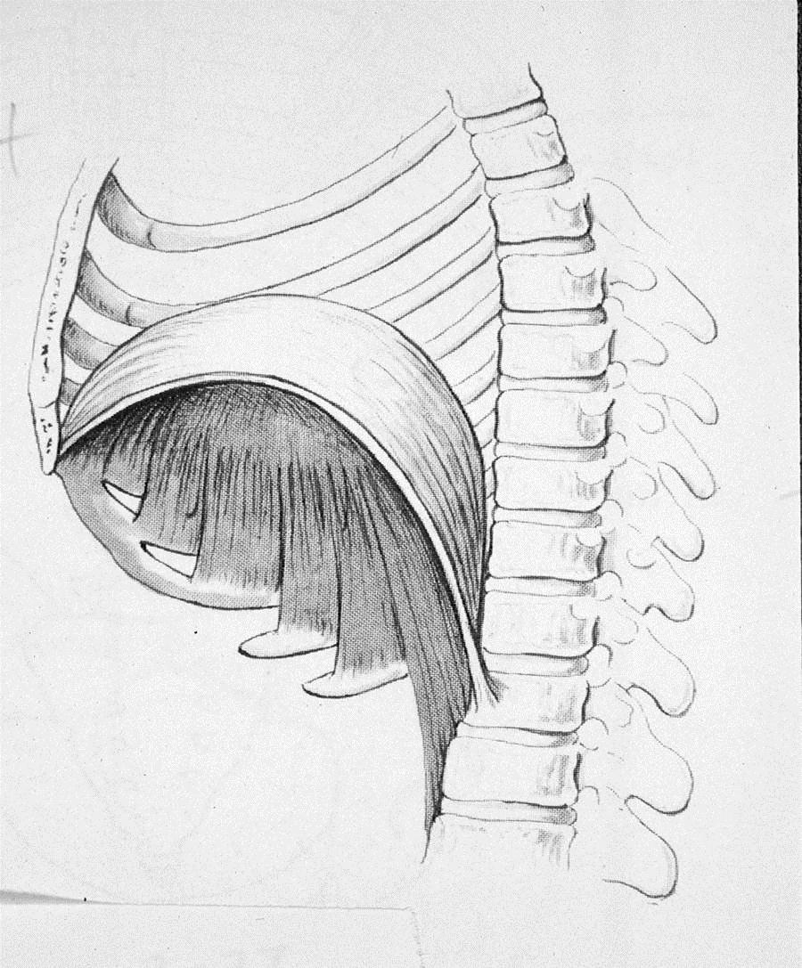 Diaphragm Drawing at Explore collection of