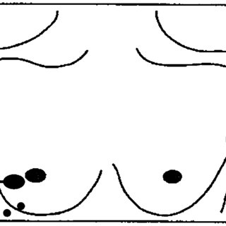 320x320 disease presentation - Disease Drawing