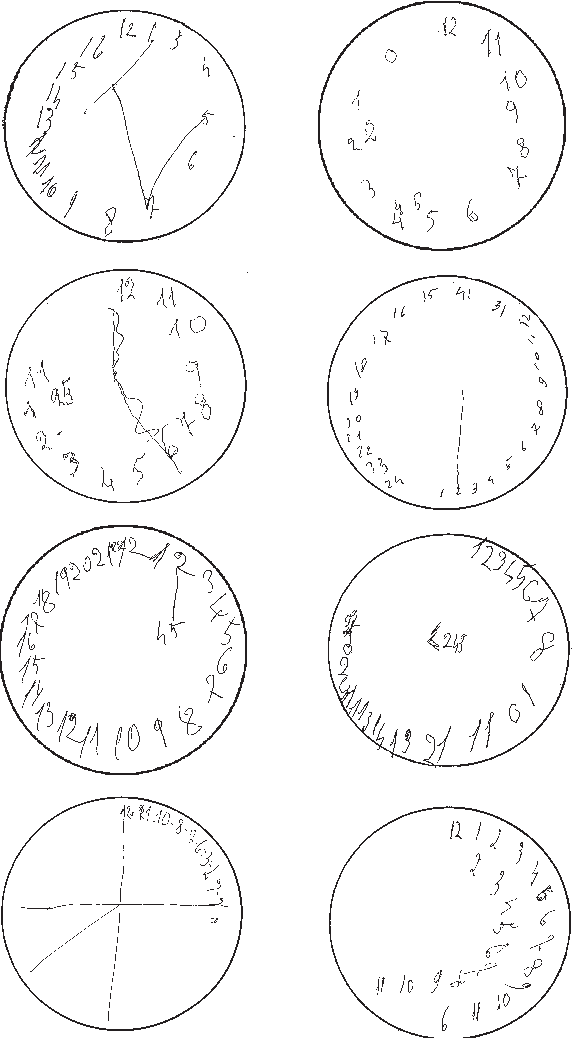 572x1038 figure from drawing disorders in alzheimer's disease and other - Disease Drawing