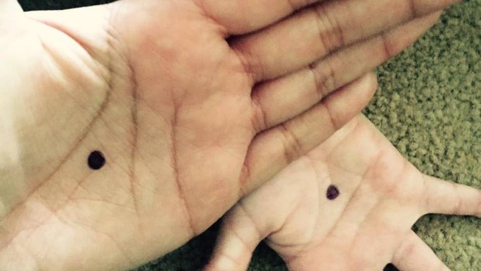 680x383 domestic violence victims are drawing black dots on their hands - Domestic Violence Drawing
