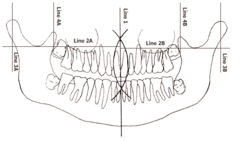 850x496 drawing demonstrating modified levandoski panoramic analysis - Drawing Analysis