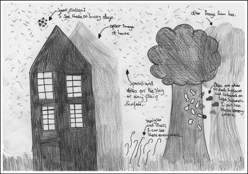 850x597 An Original Drawing Of Visual Snow Made - Drawing Of Snow