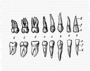 340x270 Wisdom Tooth Drawing - Drawing Of The Teeth