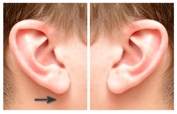 600x388 how to paint a realistic ear in adobe photoshop - Ear Drawing Reference