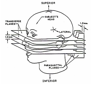 Eardrum Drawing at PaintingValley.com | Explore collection of Eardrum ...