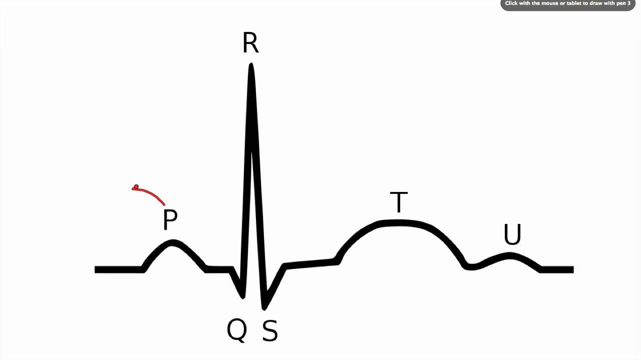 Ecg Drawing at PaintingValley.com | Explore collection of Ecg Drawing