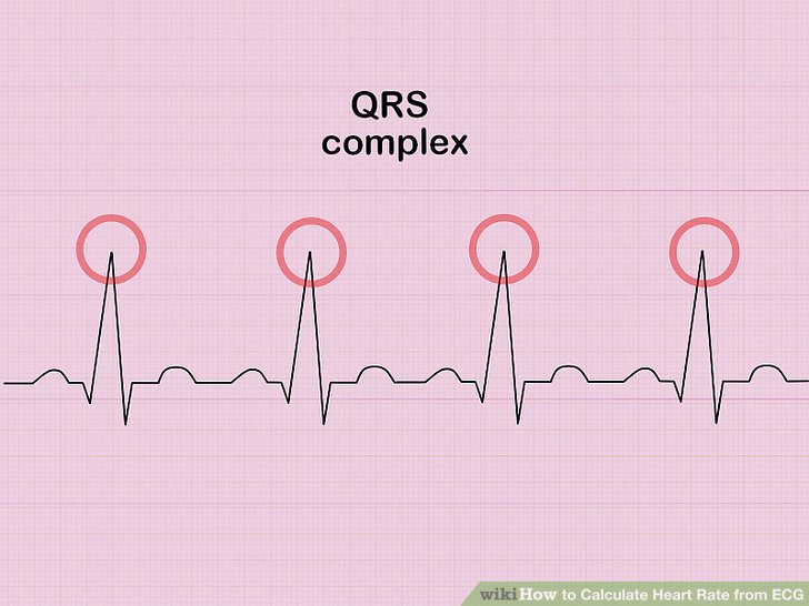 728x546 How To Measure And Calculate Heart Rate From Ecg - Ecg Drawing
