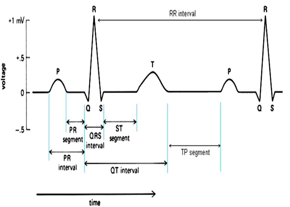 980x698 Real Time Ecg Qrs Detection - Ecg Drawing
