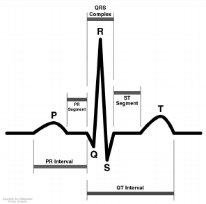 296x293 Schematic Representation Of Normal Ecg Download Scientific Diagram - Ecg Drawing