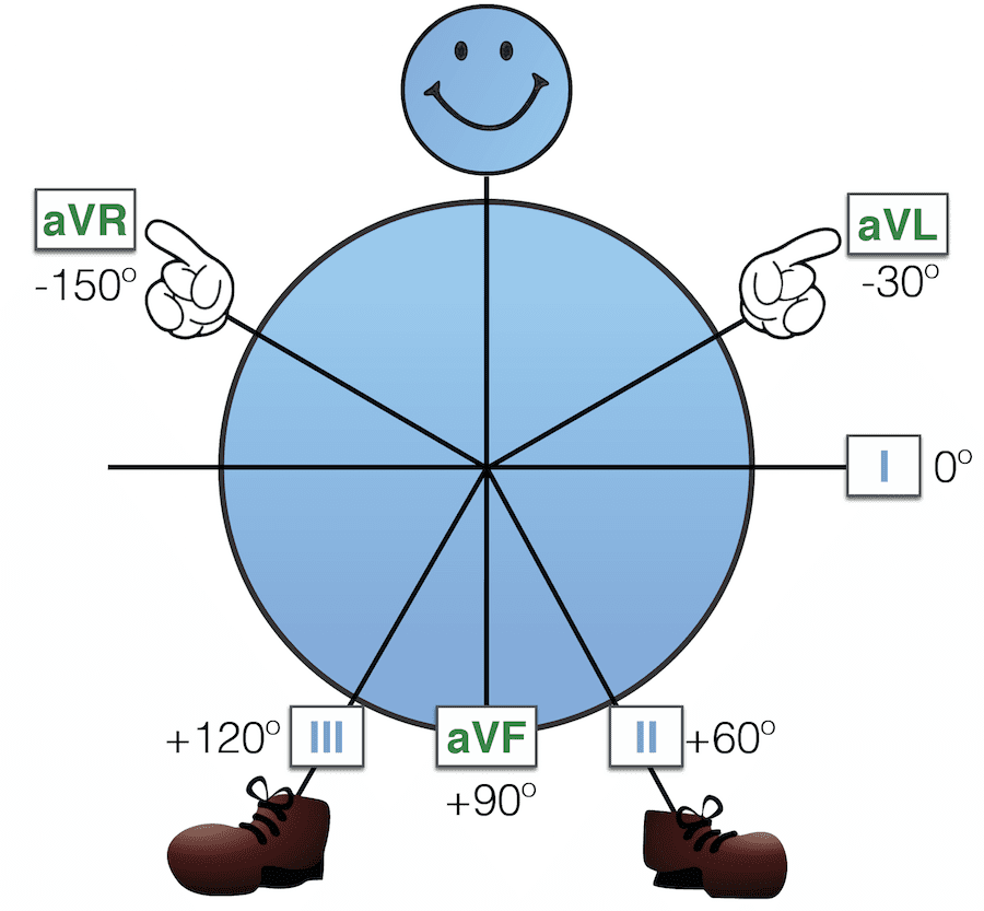 900x833 Super Axis Man Sam Litfl Medical Blog Ecg Library Basics - Ecg Drawing