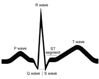 346x275 Understanding An Ecg Geeky Medics - Ecg Drawing