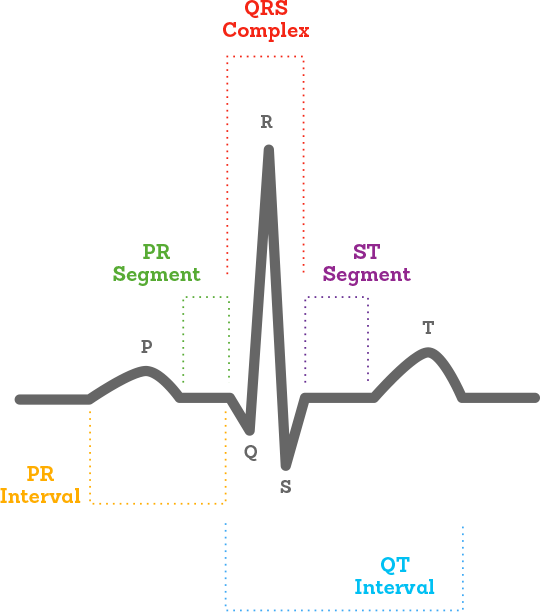 Ecg Drawing at PaintingValley.com | Explore collection of Ecg Drawing