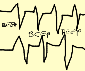 300x250 ekg drawing - Ekg Drawing